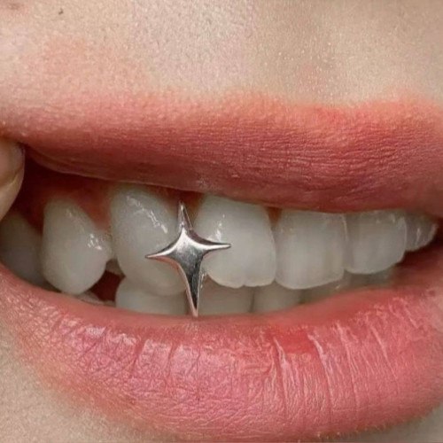گریلز دندون درخشش ✨-image